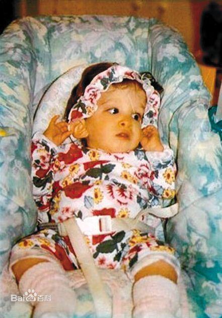 一岁女婴死亡原因(不老女婴离奇离世)