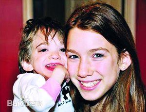 一岁女婴死亡原因(不老女婴离奇离世)