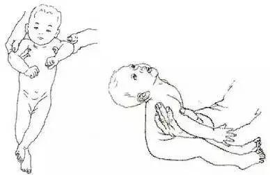 什么情况引起宝宝肌张力高（宝宝肌张力高的表现）