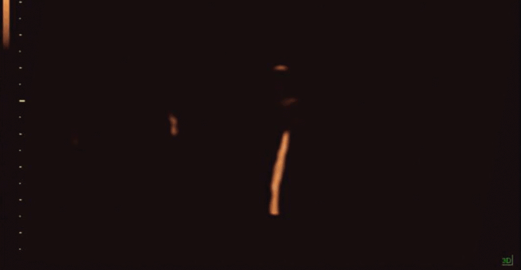 正在备孕怎么检查输卵管是否通畅(备孕那么久了怎么还不怀孕)