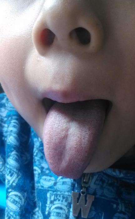 宝宝脾胃差是什么原因导致的（宝宝脾胃总不好）