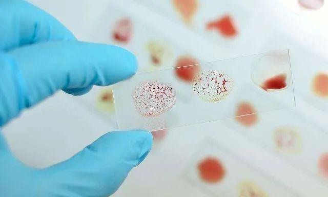 o型血妈妈宝宝容易溶血吗(妈妈是O型血宝宝会溶血吗)