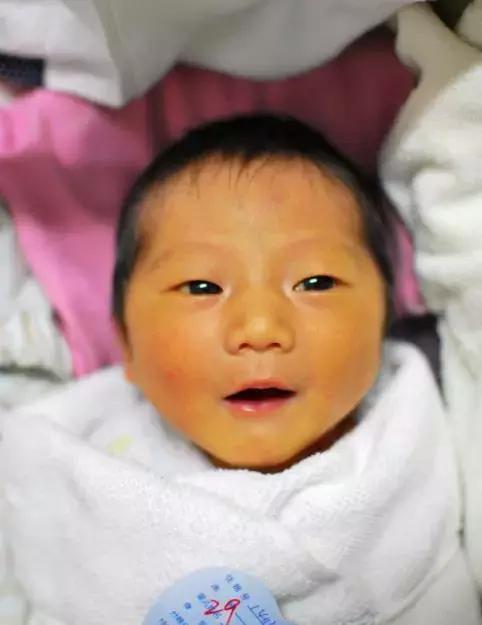 新生儿黄疸怎么预防最有效（很多宝妈都为宝宝的黄疸久不退消苦恼）